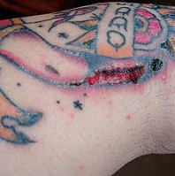 infected-tattoo.jpg