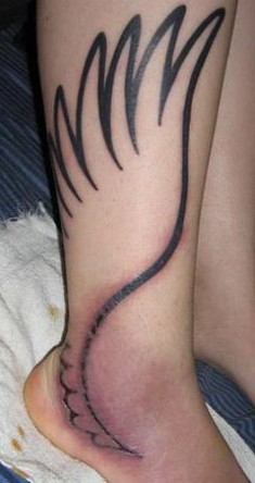 Tattoo Infection