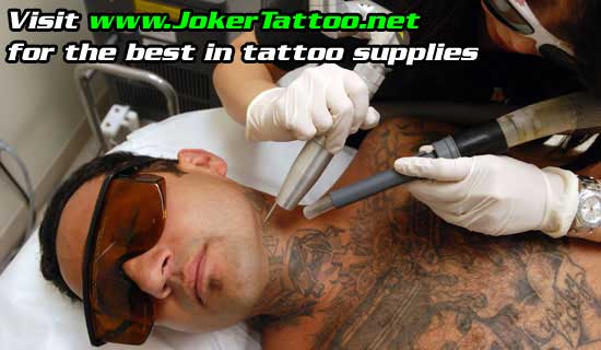 remove tattoo. Avoiding Laser Tattoo Removal